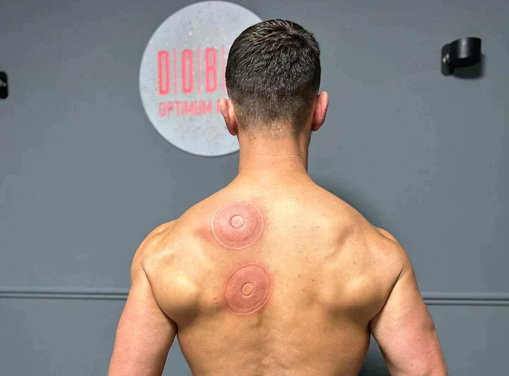 Portable Cupping Massage Device with Heat | Beauty Box